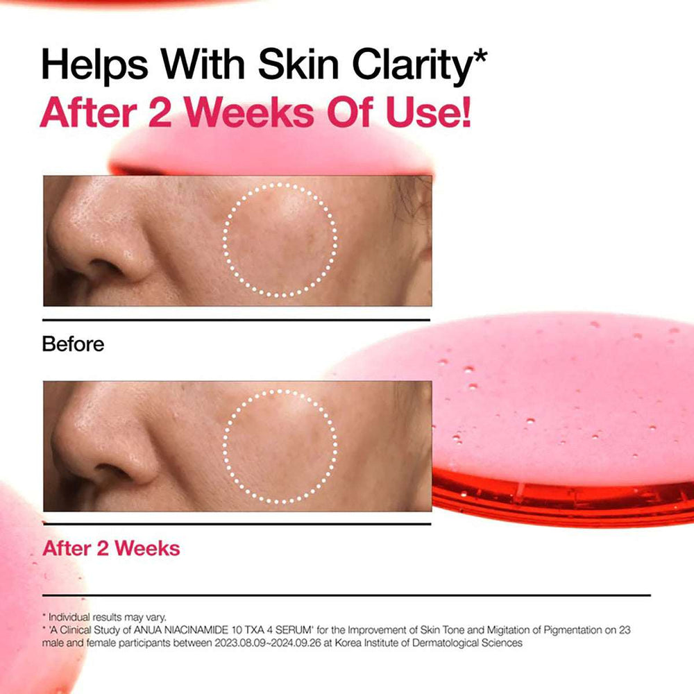 Anua niacinamide 10% + TXA 4% dark spot removing serum 30ml