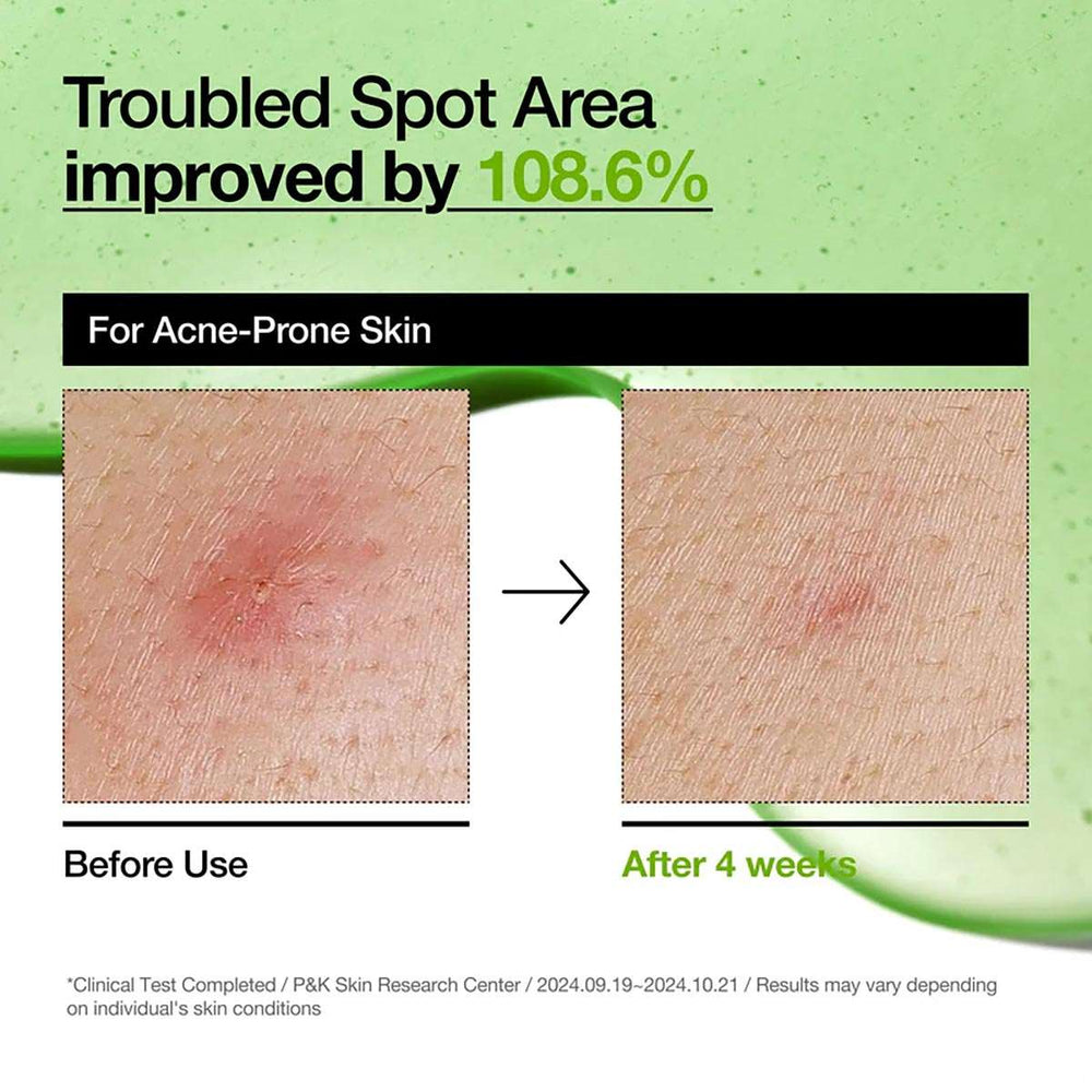 ANUA Azelaic Acid 10 Hyaluron Redness Soothing Serum 30ml