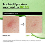 ANUA Azelaic Acid 10 Hyaluron Redness Soothing Serum 30ml