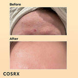 COSRX Advanced Snail 96 Mucin Power Essence 100ml - Pack of 2
