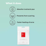 COSRX Acne Pimple Patch (24 Patches) - Pack Of 2