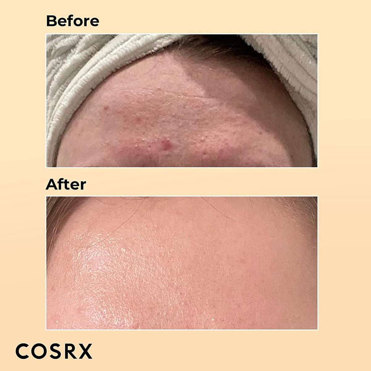 COSRX Advanced Snail 96 Mucin Power Essence 100ml - Pack of 2