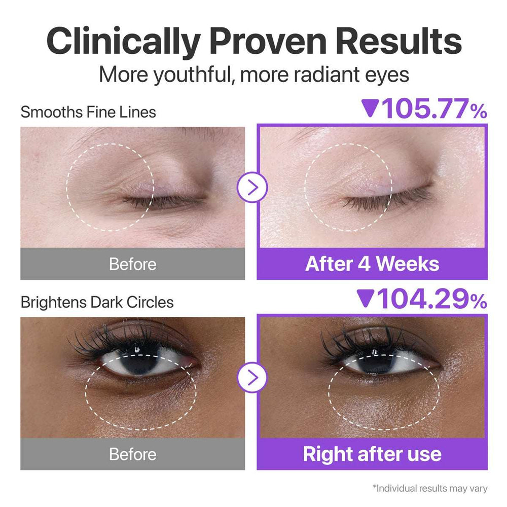 Numbuzin No.9 NAD+ Retinol Eye Cream 10ml